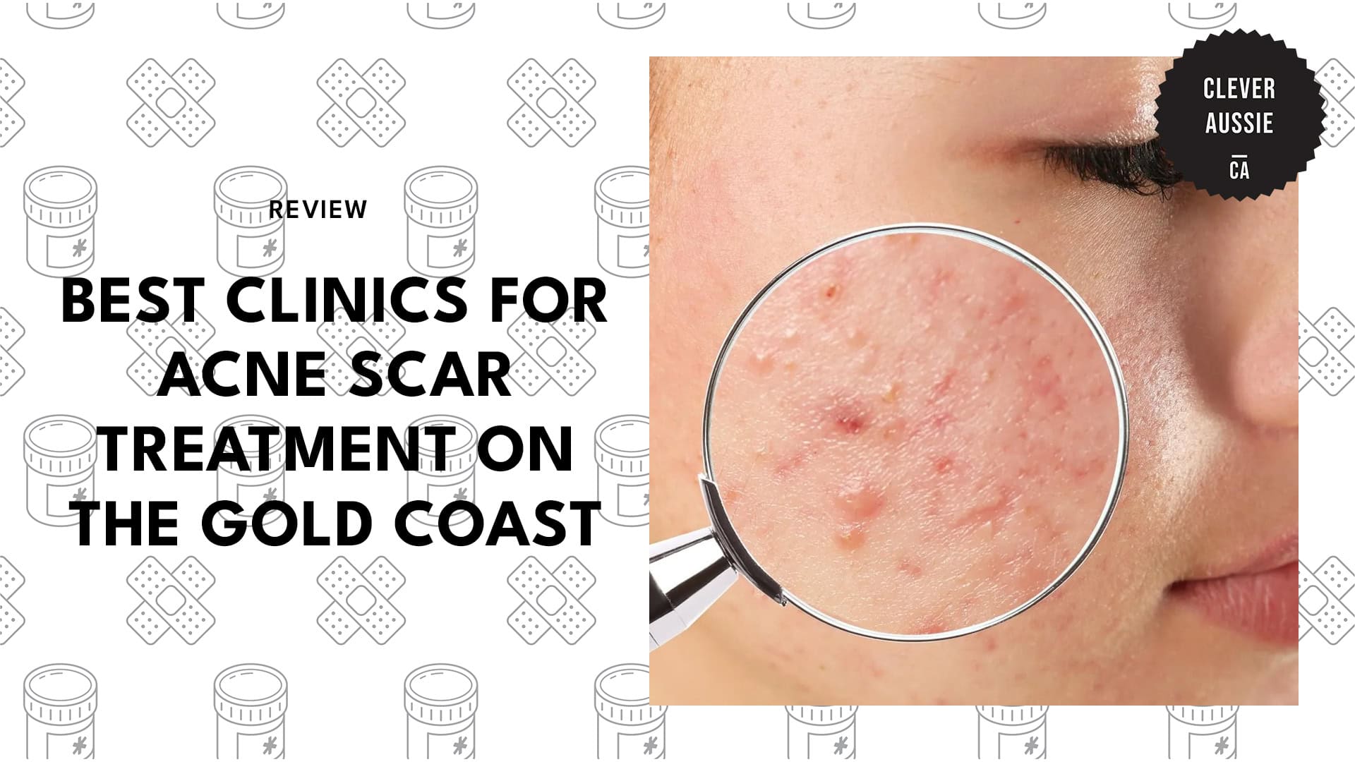 acne-scar-treatment-clinics-on-the-gold-coast